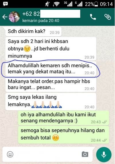 Cara Alami Mengobati Lemak Di Mata Sampai Sembuh Total